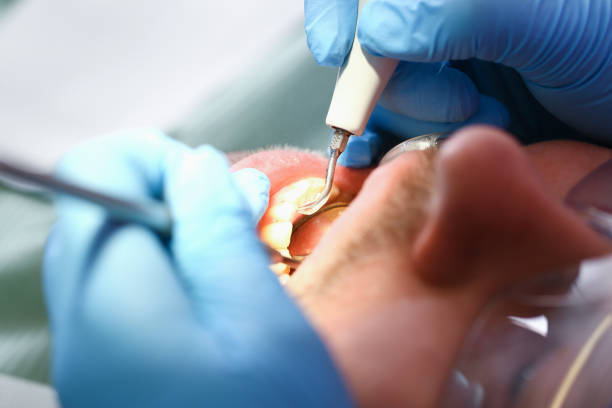 Best Emergency Treatment for Oral Infections in Elmore, OH