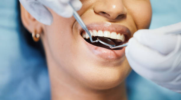 Best Broken or Chipped Tooth Repair in Elmore, OH